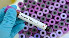 Coronavirus positive